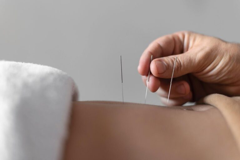 Myotherapy Albert Park